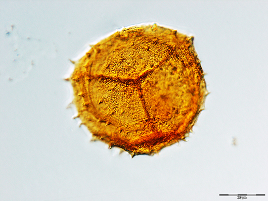 kraeuselisporites apiculatus Foto Peter Hochuli